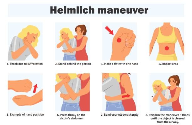Maniobra de Heimlich