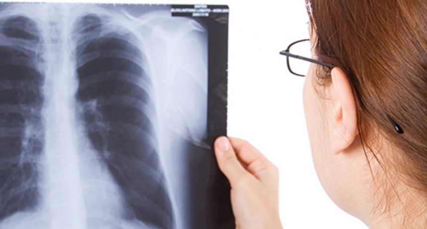 La columna del Dr. Celeste