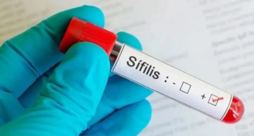 La columna del Dr. Celeste